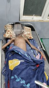 Haji Uma Bantu Biaya Pendampingan Untuk Anak Penderita Gizi Buruk
