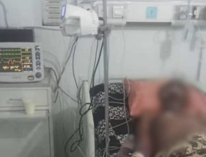 Akibat Abu Panas Boiler Dua Karyawan PKS KPJ Akhirnya Meninggal Dunia
