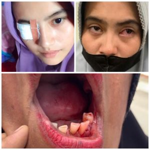 Satu Keluarga Kaum Hawa Dianiaya, Pelaku Dituntut Ringan